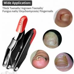 BRIDAY Ensemble De Pinces à Ongles, Ensemble De Pinces à Ongles Ubitree Coupe-ongles En Acier Inoxydable Pour Ongles épais Et Incarnés, Panaris, Onychomycose, Mycose Des Ongles, Coupe-ongles Pinces à Cuticules, Kit De Pinces à Ongles Incarnés -Pince et tenaille Soldes 35562733 3
